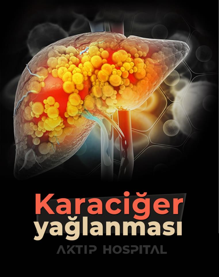 Karaciğer Yağlanması